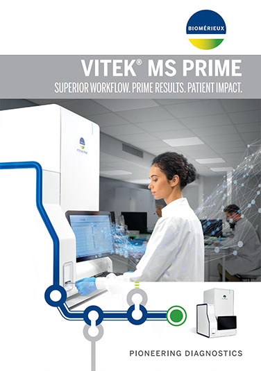 VITEK® MS Selection of Prime